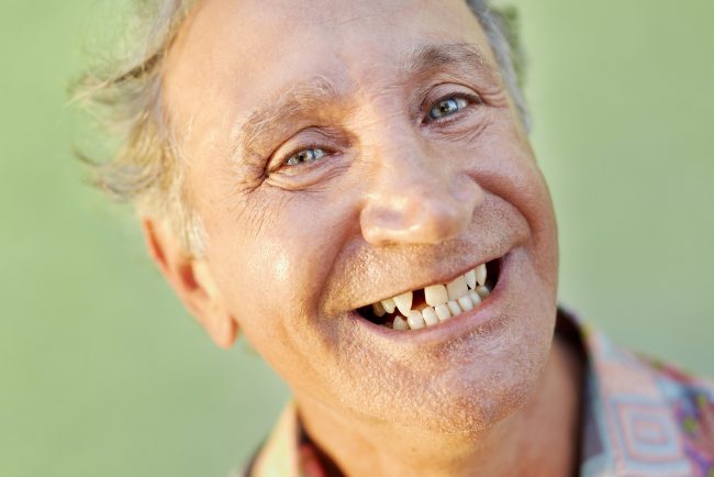 What Are Symptoms Of Gum Disease - AL-Fa Perio