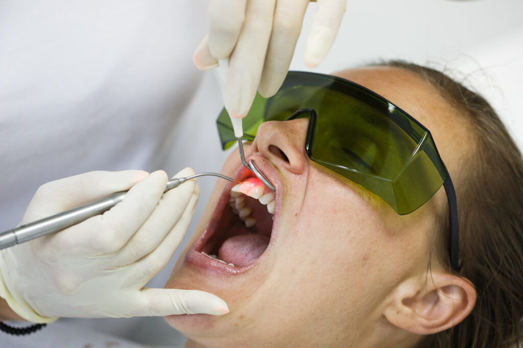 Periodontal disease - Al-Fa Perio Clinic