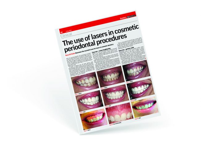 Cosmetic periodontal Procedures - Al-Fa Perio