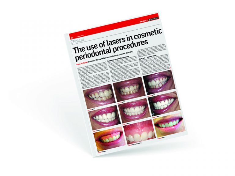 Cosmetic periodontal Procedures - Al-Fa Perio