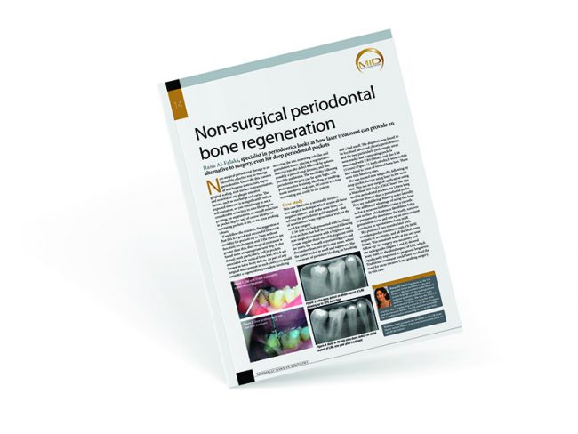 Non-surgical Periodontal - Al-Fa Perio