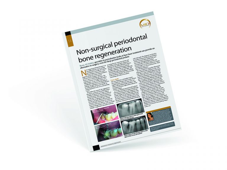 Non-surgical Periodontal - Al-Fa Perio