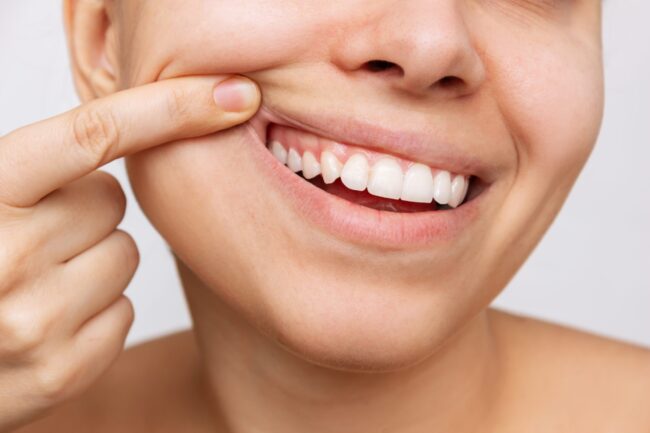 Why are gums so important in your mouth?