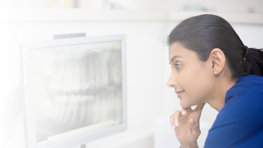 Cheapest dental implants uk - Al-Fa Perio Clinic