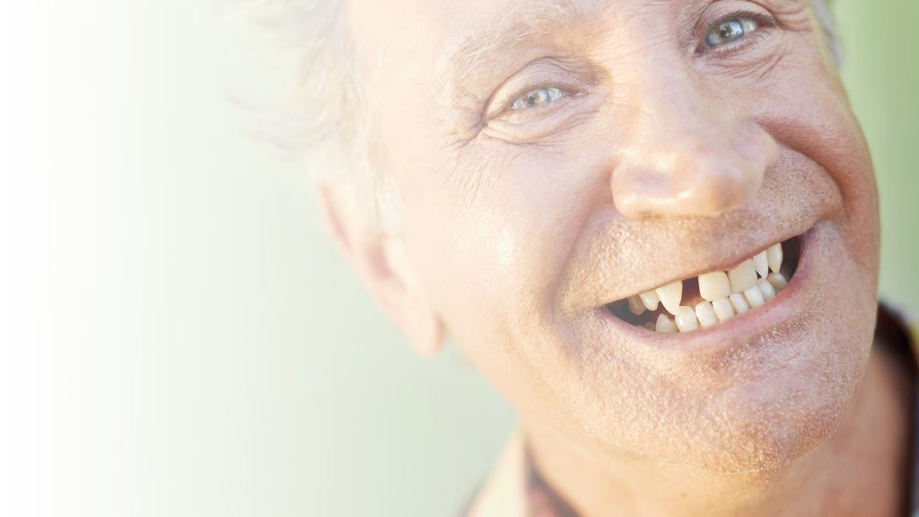 Fee dental implants for low income uk - Al-Fa Perio Clinic